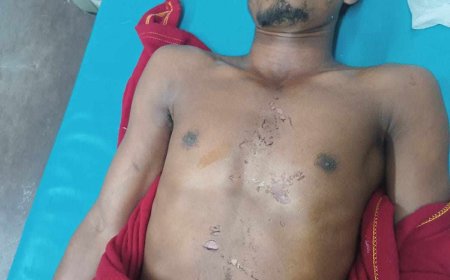 মাদারীপুরে বজ্রপাতে কৃষকের মৃত্যু