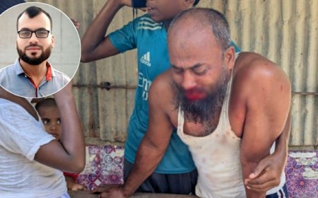 মহিপুরে যুবদল নেতার ঘুষিতে নাক ফাটলো ছোট ভাইয়ের