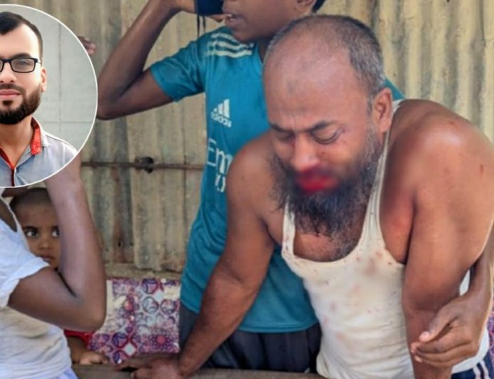 মহিপুরে যুবদল নেতার ঘুষিতে নাক ফাটলো ছোট ভাইয়ের