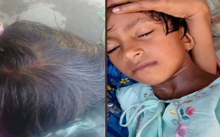 হাটুভাঙ্গা ব্রিজে টোল আদায়ে বিলম্ব, লাঠির আঘাতে শিশুর মাথা ফাটার অভিযোগ