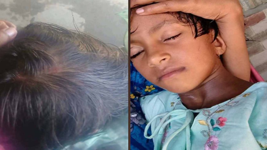 হাটুভাঙ্গা ব্রিজে টোল আদায়ে বিলম্ব, লাঠির আঘাতে শিশুর মাথা ফাটার অভিযোগ